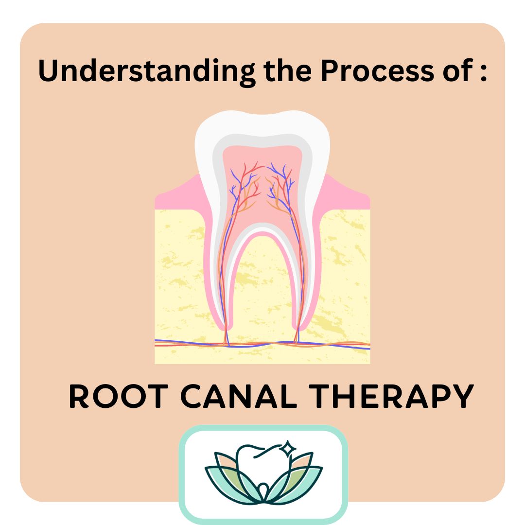 understanding the process of root canal therapy