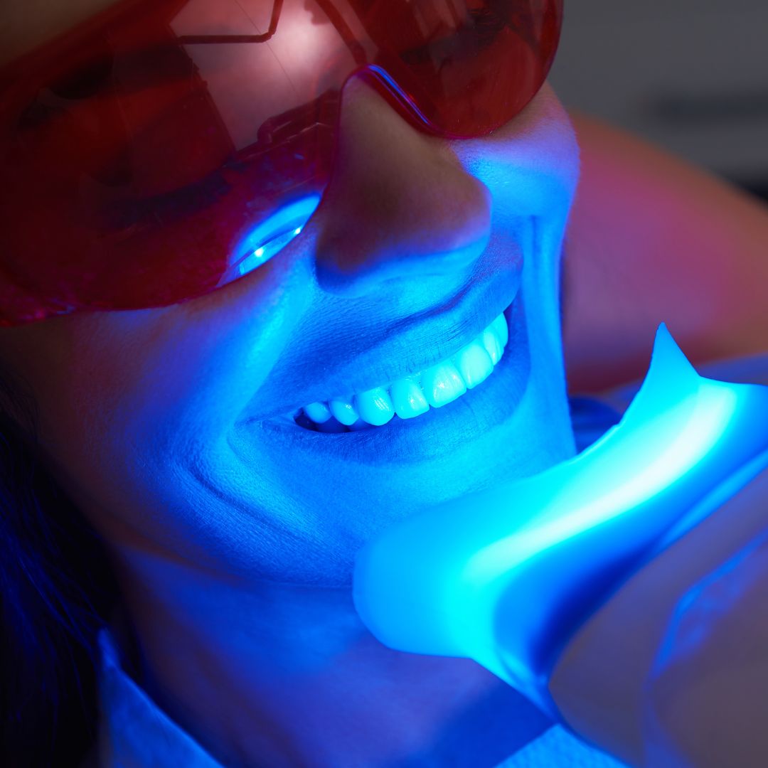 teeth whitening