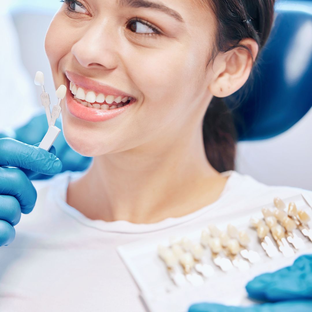 veneers